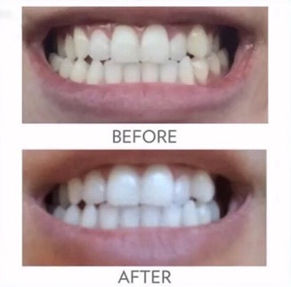 ap 24 whitening toothpaste